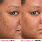 Sérum Bye Bye Dark Spots