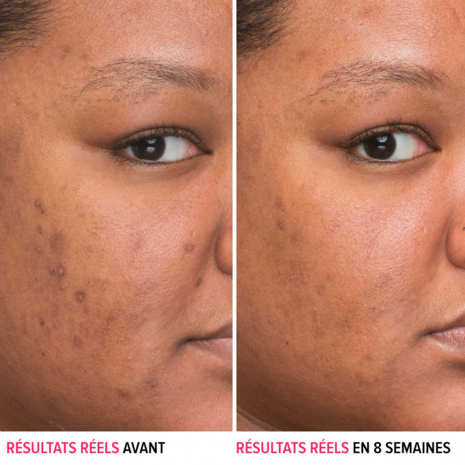 Sérum Bye Bye Dark Spots
