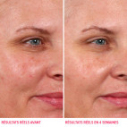 Hello Results Exfoliante