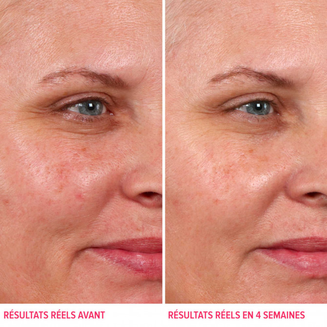 Hello Results Exfoliante
