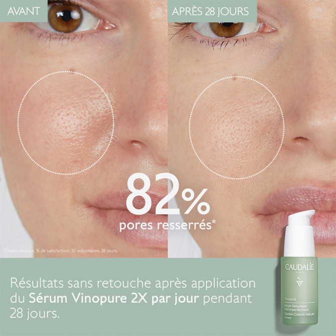 Sérum Infusion Anti-Imperfections