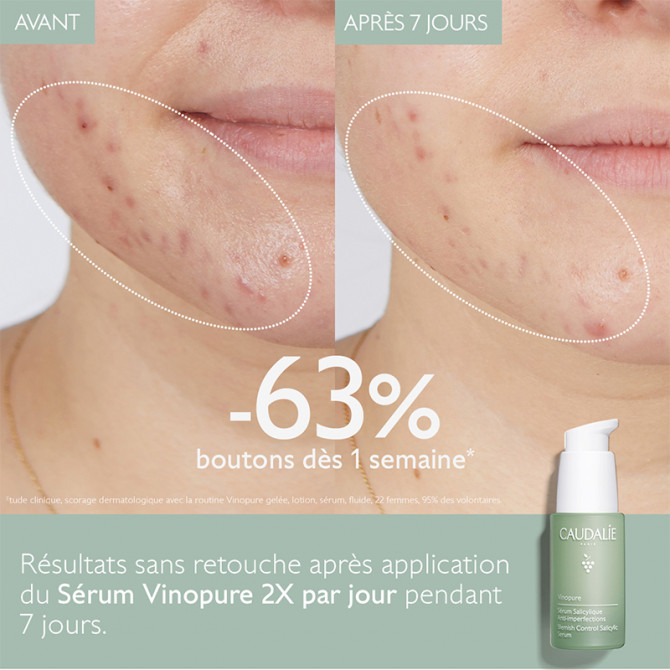 Sérum Infusion Anti-Imperfections
