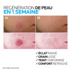 Cicaplast B5 Sérum