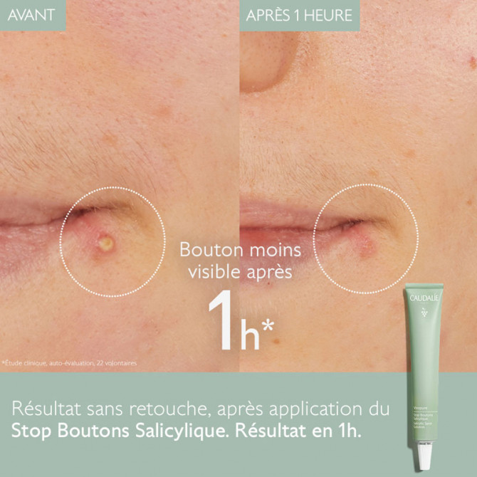 Stop Boutons Salicylique