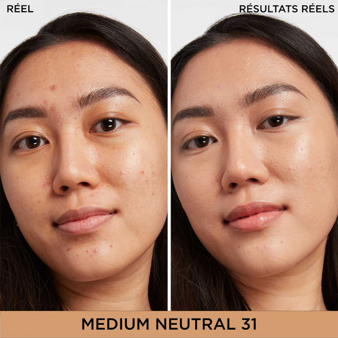 Bye Bye Darkspots Concealer 31