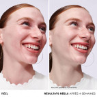 Sérum Bye Bye Redness
