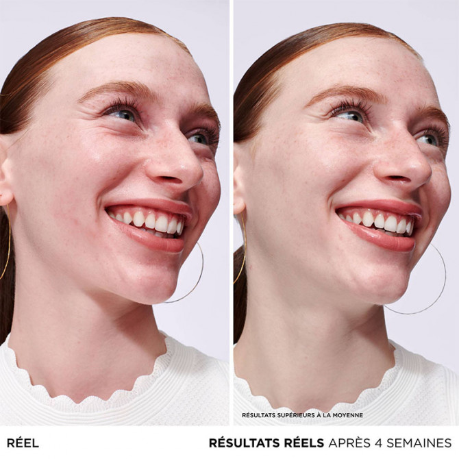 Sérum Bye Bye Redness