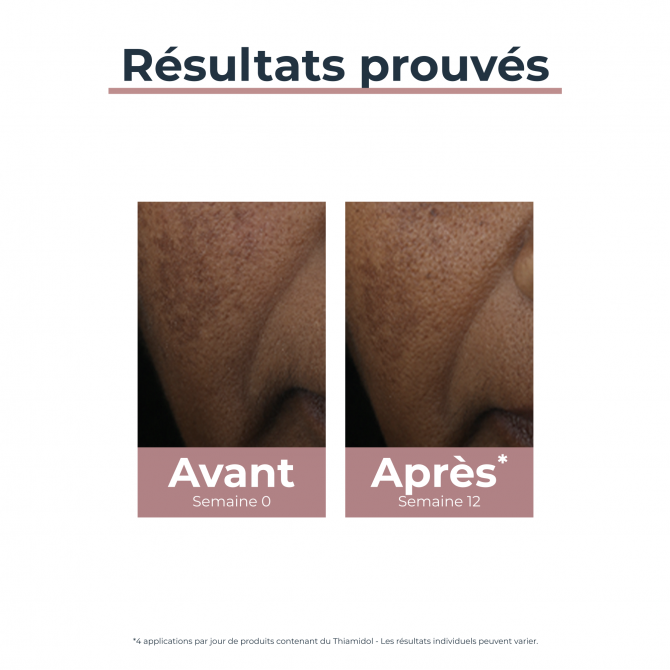 ANTI PIGEMENT CORRECTEUR DE TACHES