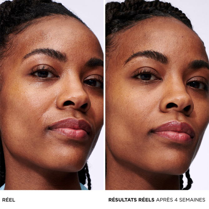 Confidence in a Gel Cream