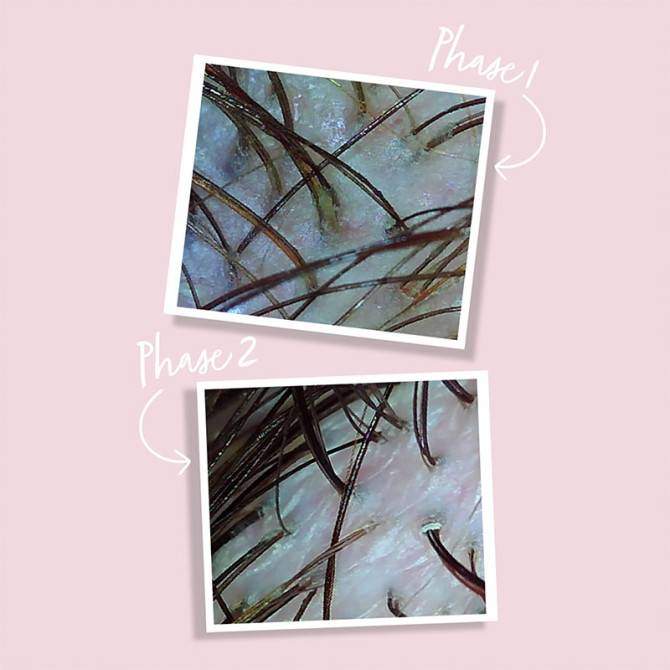 Detoxifying Scalp Oil