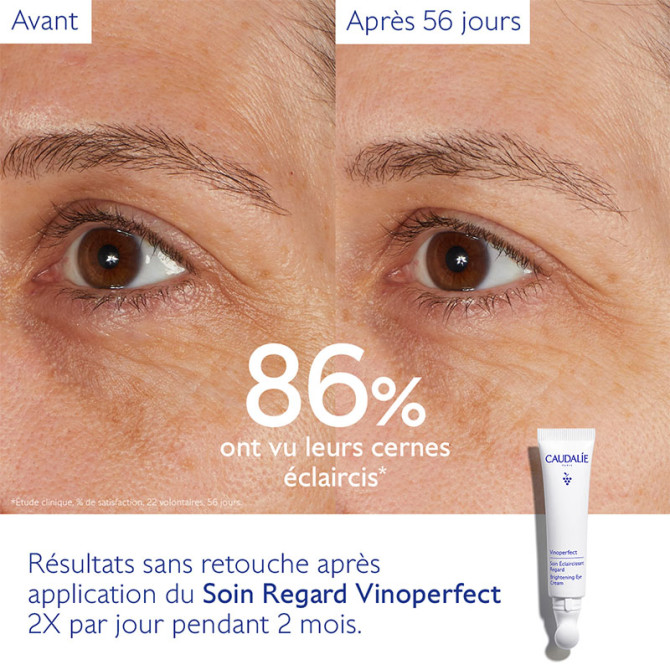 Verhelderende oogverzorging