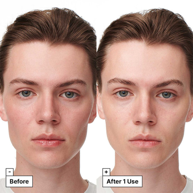 Intensive beruhigende und regenerierende Serum-Maske