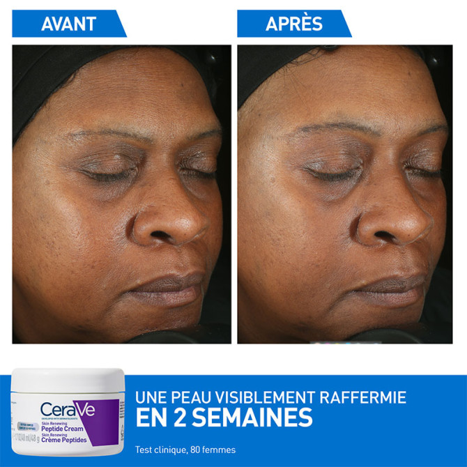 Skin Renewing Crème Peptides