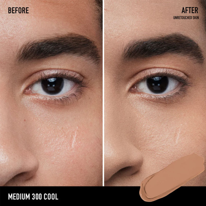 All Over Skin Perfecting Concealer Medium 300 Cool