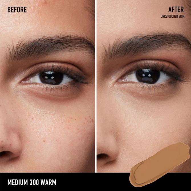 All Over Skin Perfecting Concealer Medium 300 Warm