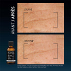Daily Anti-Wrinkle Peel
