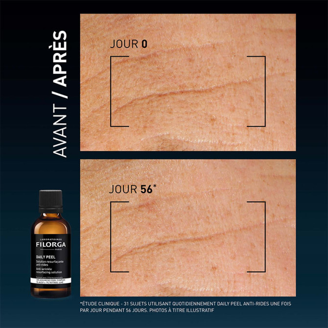 Daily Anti-Wrinkle Peel