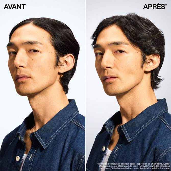 Après Shampooing Densité 300 ml