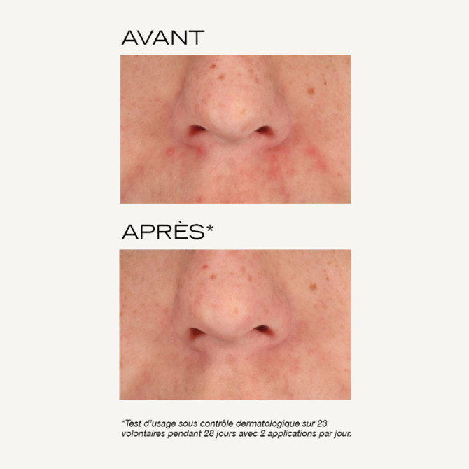 Intensiv-Peeling-Maske