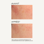 Intensiv-Peeling-Maske