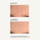Intensiv-Peeling-Maske