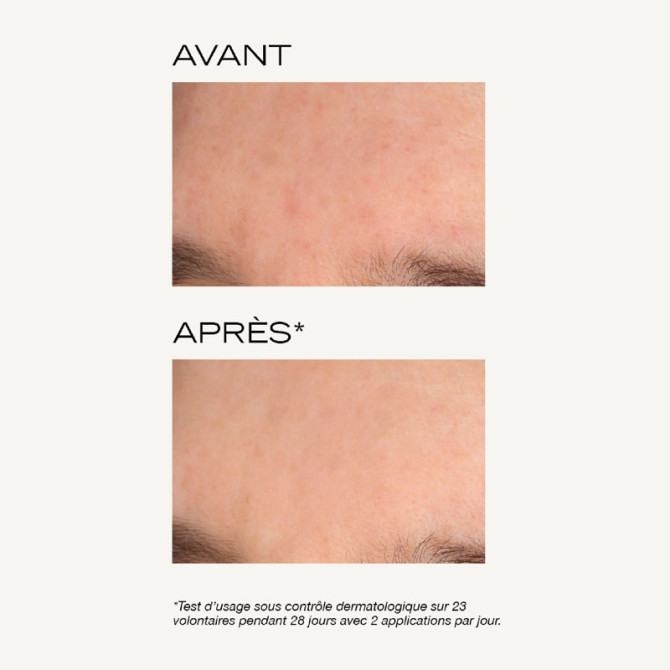 Intensiv-Peeling-Maske