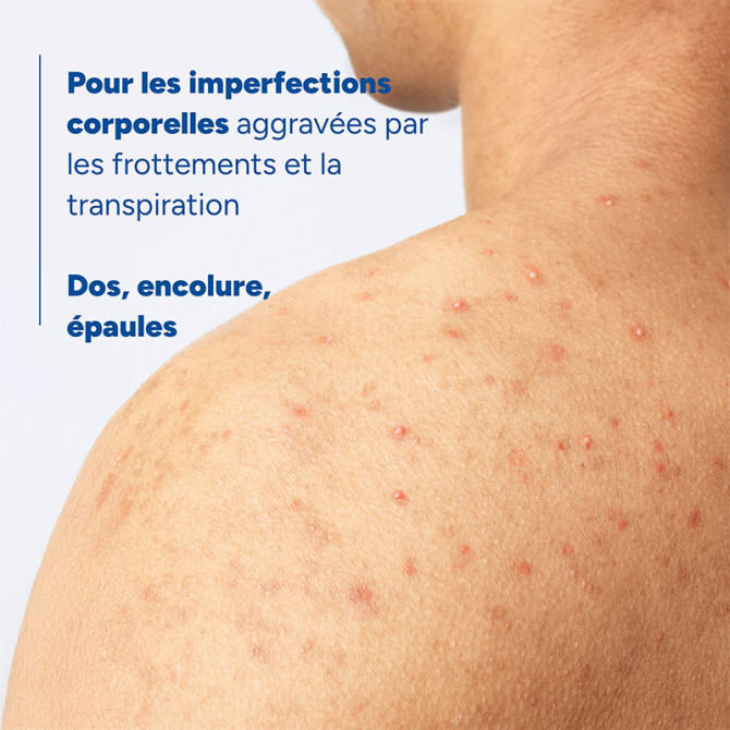 Spray corpo astringente anti-brufoli