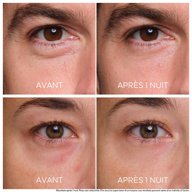 Abeille Royale