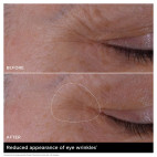 Double Serum Eye