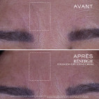 Rénergie Collagen+ Lift-Xtend-crème