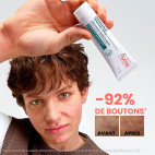 Comedomed Peeling