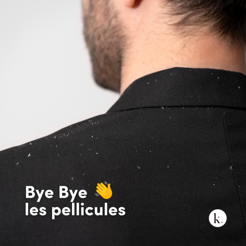 Pellicules: les reconnaître et les traiter