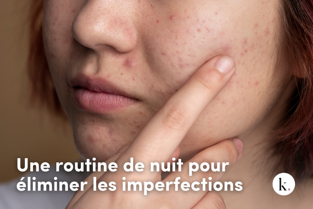 cerav_imperfections_acne_routine